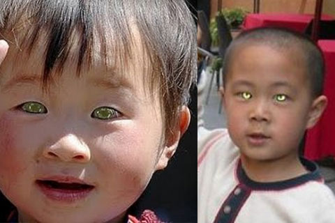 El asombroso niño chino de ojos azules que ve en la oscuridad