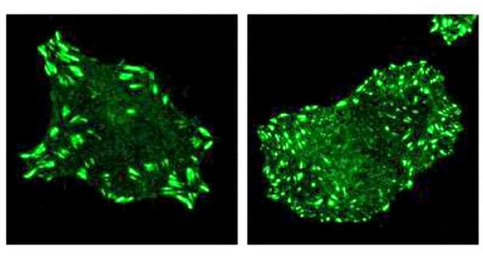 Los científicos del Instituto Salk de Estudios Biológicos de La Jolla (California, EE.UU.) han identificado un gen responsable de detener la propagación del cáncer de pulmón a otras partes del cuerpo.