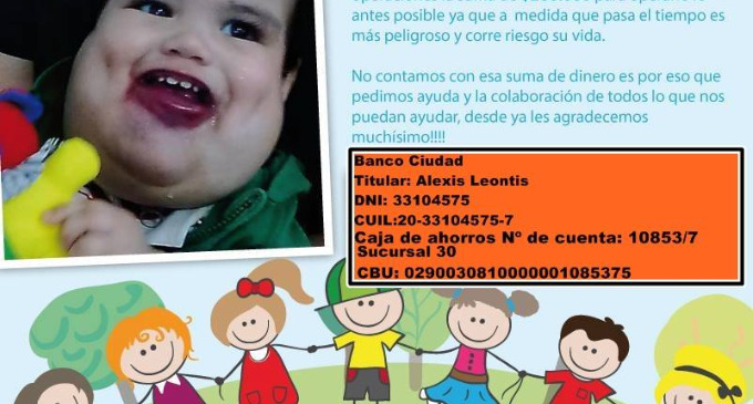 El pequeño de dos años debe ser sometido a una costosa operación ya que su vida corre peligro. En las redes sociales se difundió una campaña para ayudar a sus padres a recolectar el dinero.