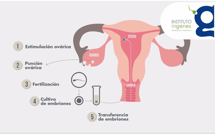 Fecundación in vitro (FIV)