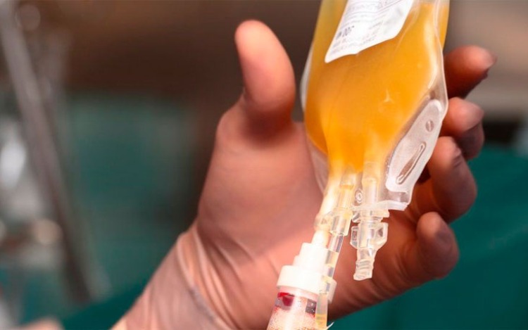 La exitosa transfusión de plasma de un paciente recuperado se transforma en un caso que da esperanza ante la pandemia del Covid-19.