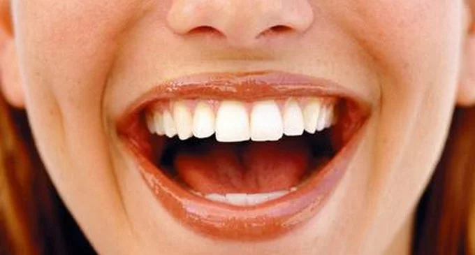 Beneficios de la risa