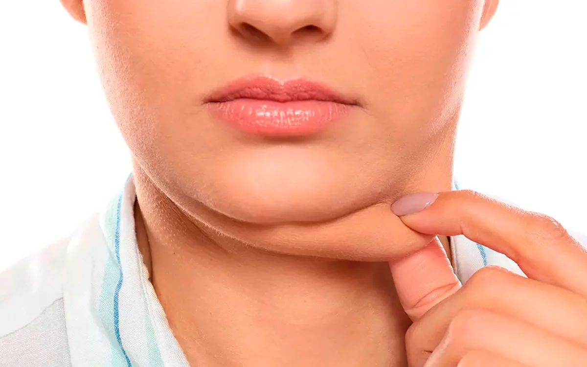 La sustancia que ayuda a eliminar la papada con solo aplicarla en la zona